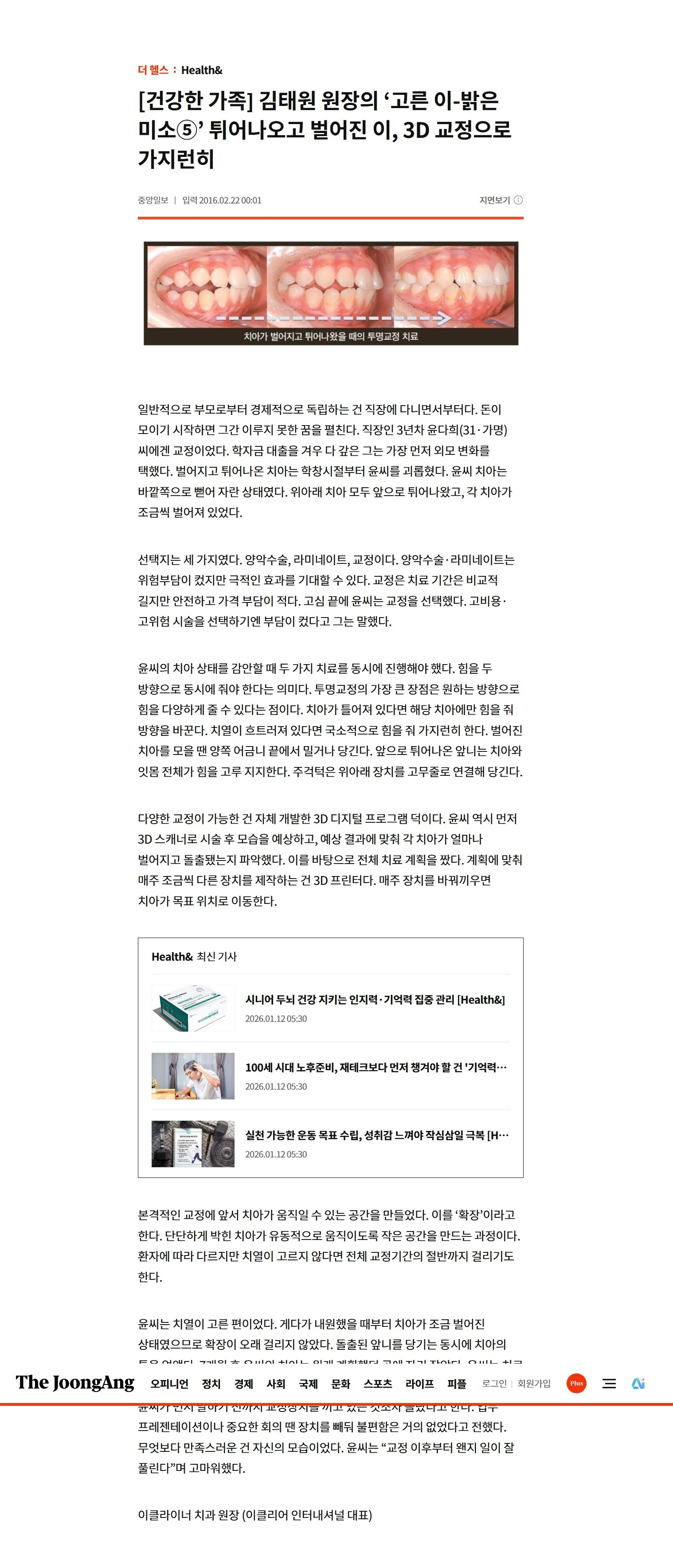 언론보도
