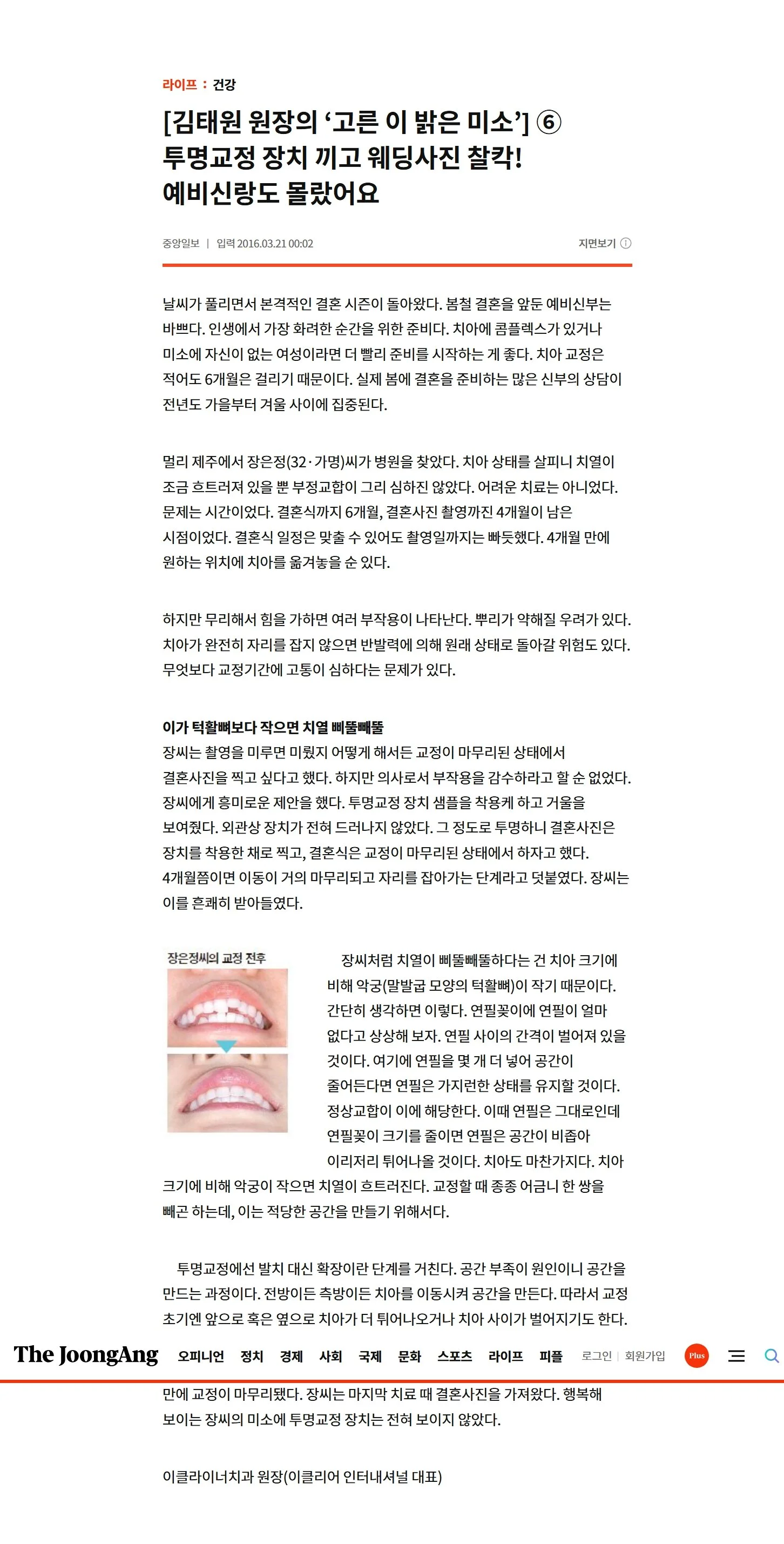 언론보도